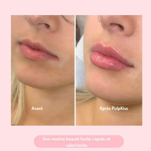 Gloss Repulpant PulpKiss