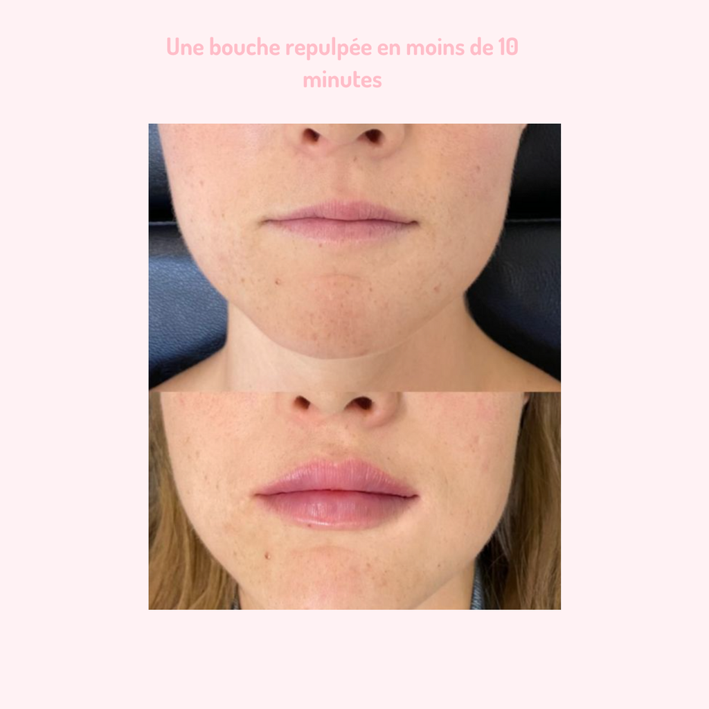 Gloss Repulpant PulpKiss