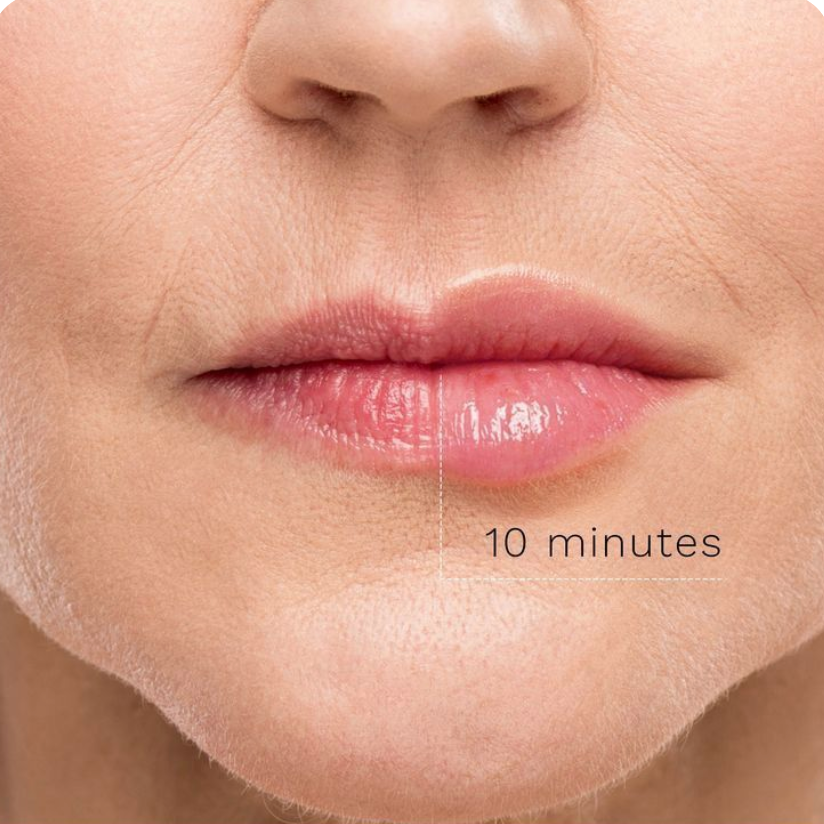 Gloss Repulpant PulpKiss