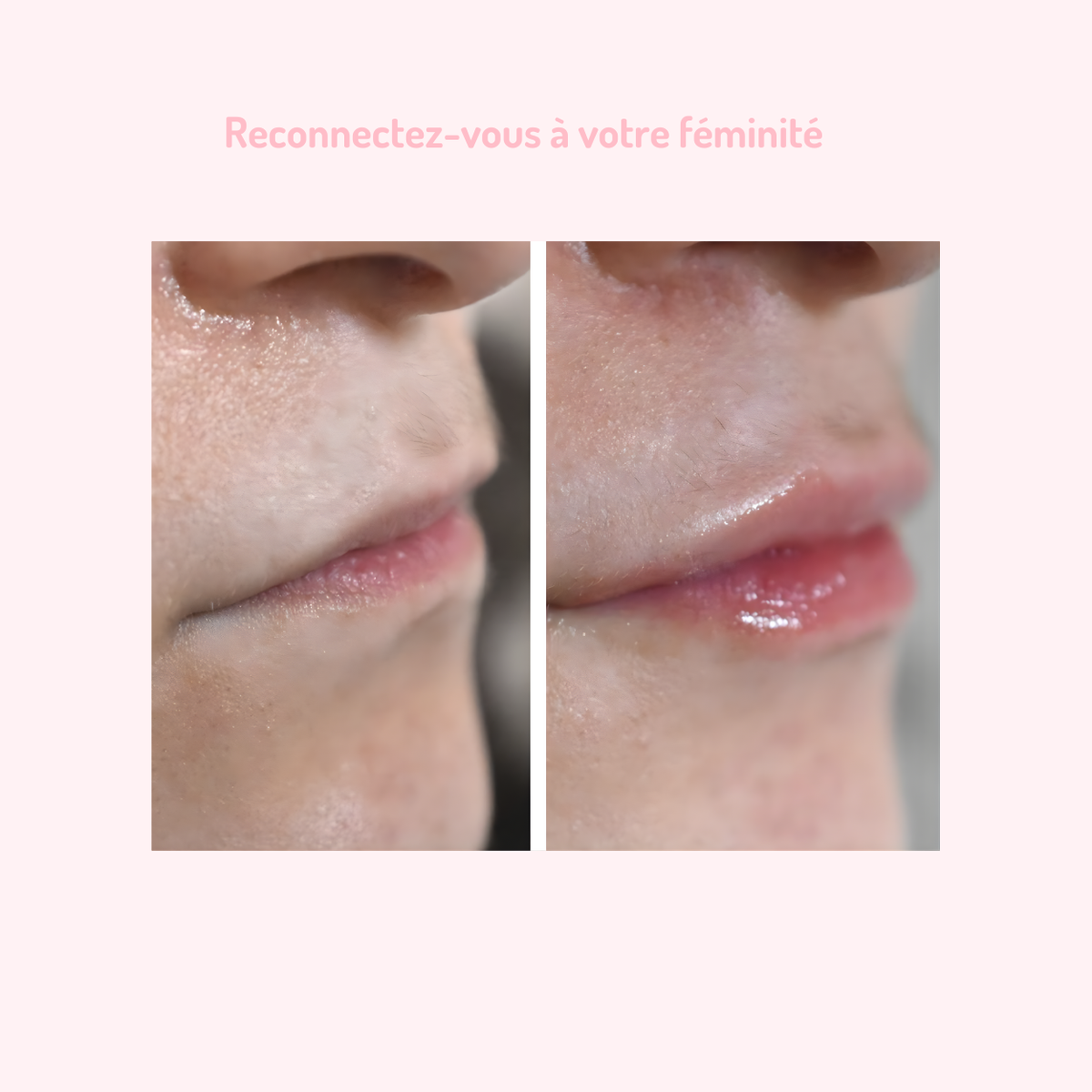 Gloss Repulpant PulpKiss