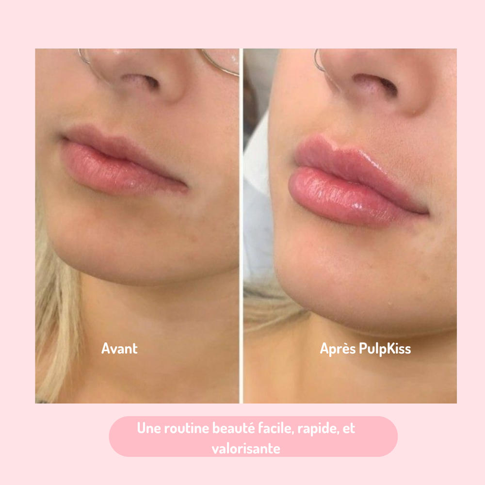 Gloss Repulpant PulpKiss